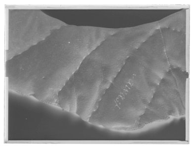 Tornerhalsputa - Livrustkammaren - 54029-negative