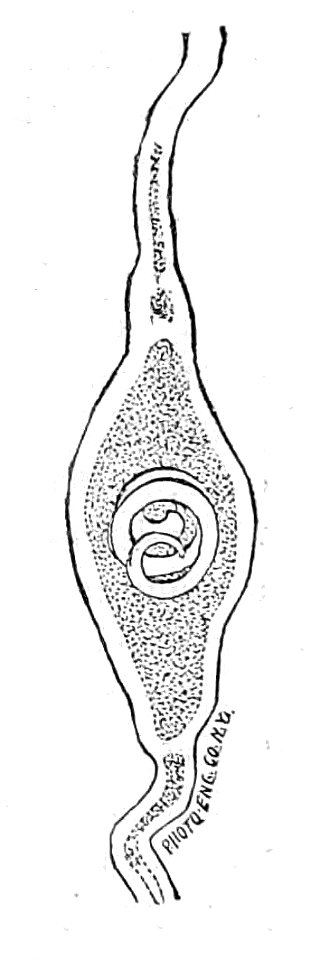 Trichinella spiralis (24)