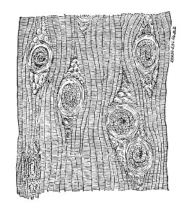Trichinella spiralis (78)