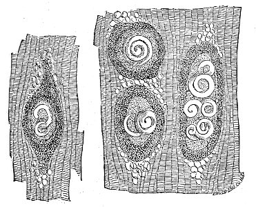 Trichinella spiralis (23)