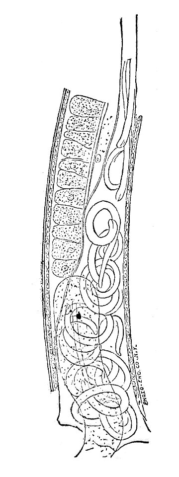 Trichinella spiralis (48)