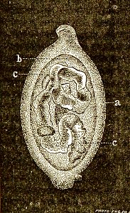Trichinella spiralis (73)