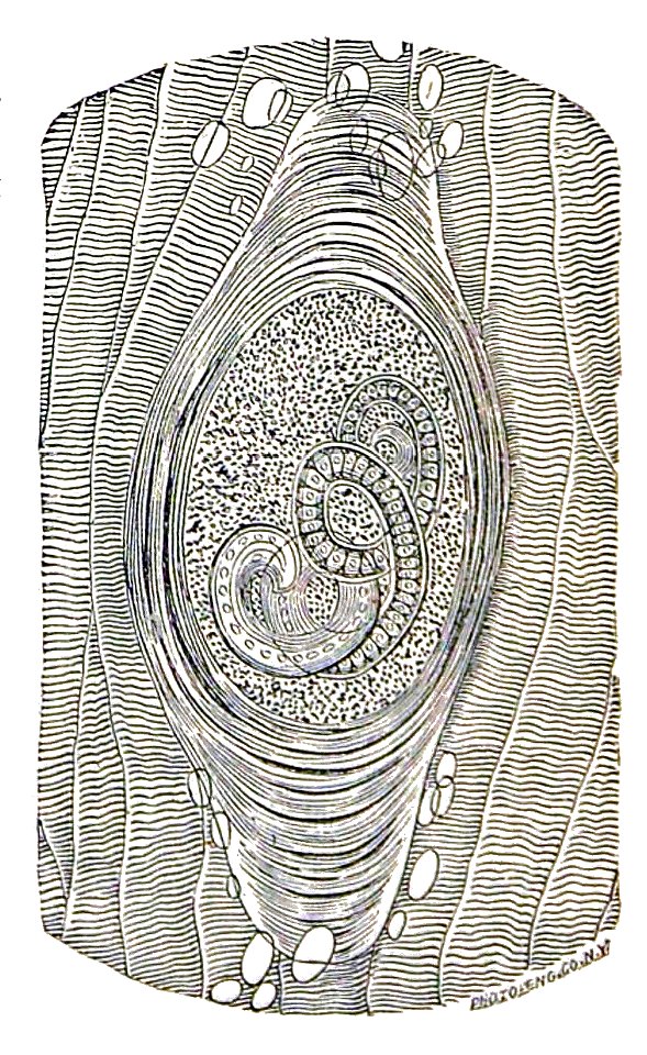 Trichinella spiralis (21)