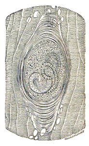 Trichinella spiralis (21)