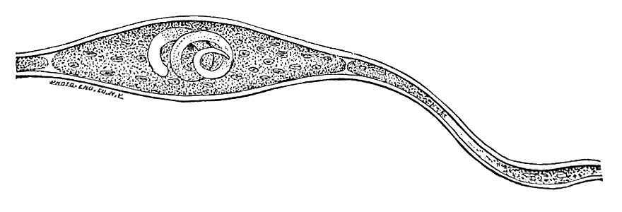 Trichinella spiralis (65)