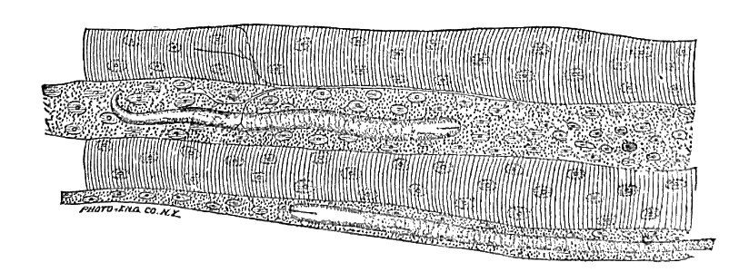 Trichinella spiralis (60)