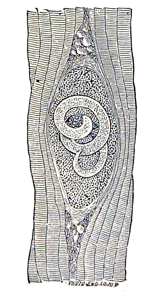 Trichinella spiralis (22)