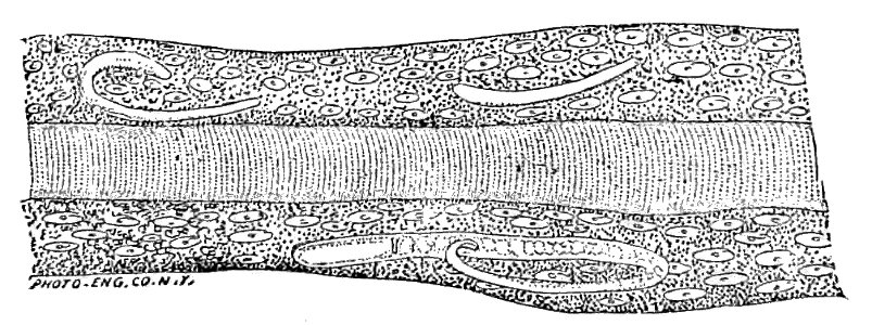 Trichinella spiralis (59)