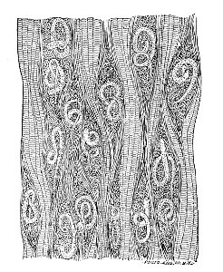 Trichinella spiralis (63)