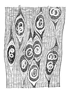 Trichinella spiralis (77)