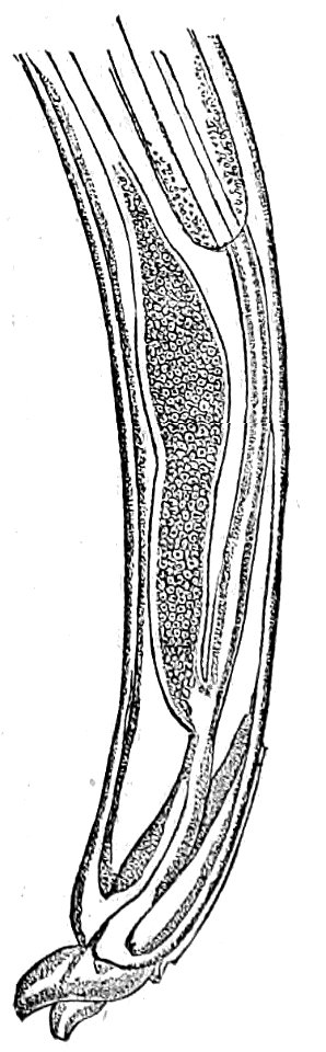 Trichinella spiralis (30)