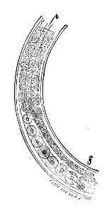 Trichinella spiralis (50)