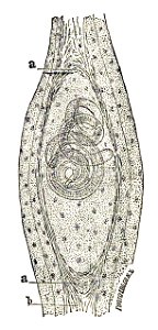 Trichinella spiralis (70)