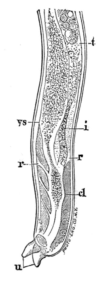 Trichinella spiralis (36)