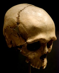 Trepanned skull from Næs Nationalmuseet