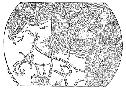 Trichinella spiralis (18)