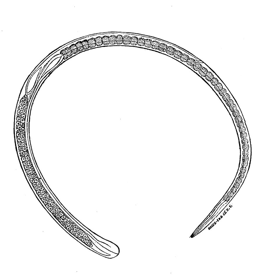 Trichinella spiralis (31)
