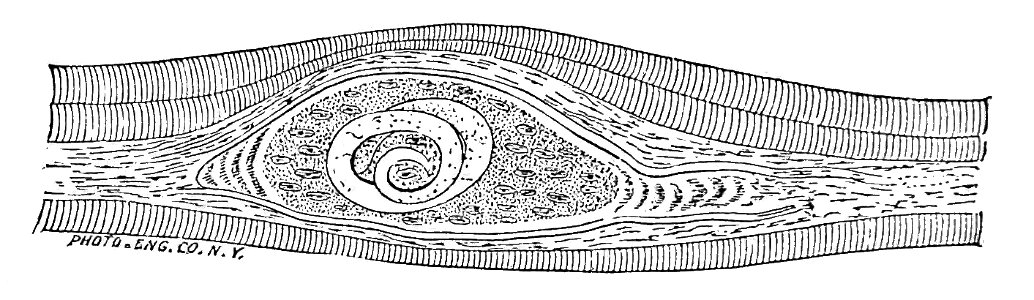 Trichinella spiralis (66)