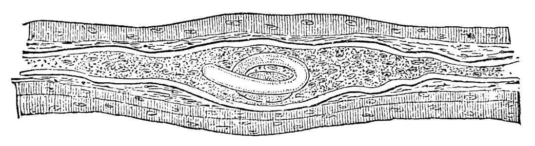 Trichinella spiralis (64)