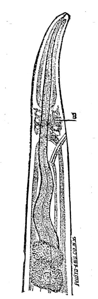 Trichinella spiralis (27)