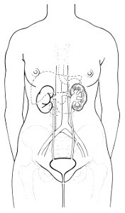 Urinary (female)