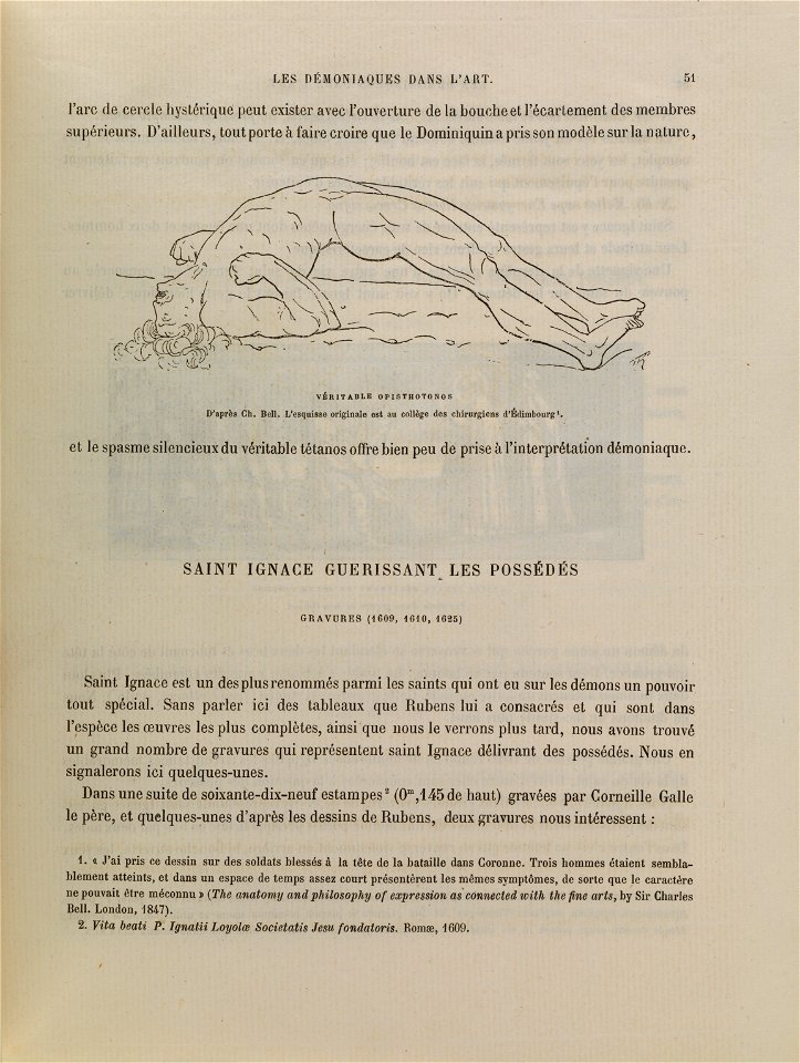 Veritable Opisthotonos. D'apres Charles Bell. Wellcome L0074813