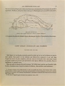 Veritable Opisthotonos. D'apres Charles Bell. Wellcome L0074813