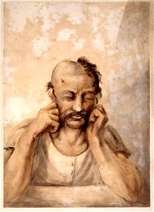 Watercolour; soldier suffering from a head Wellcome L0022555