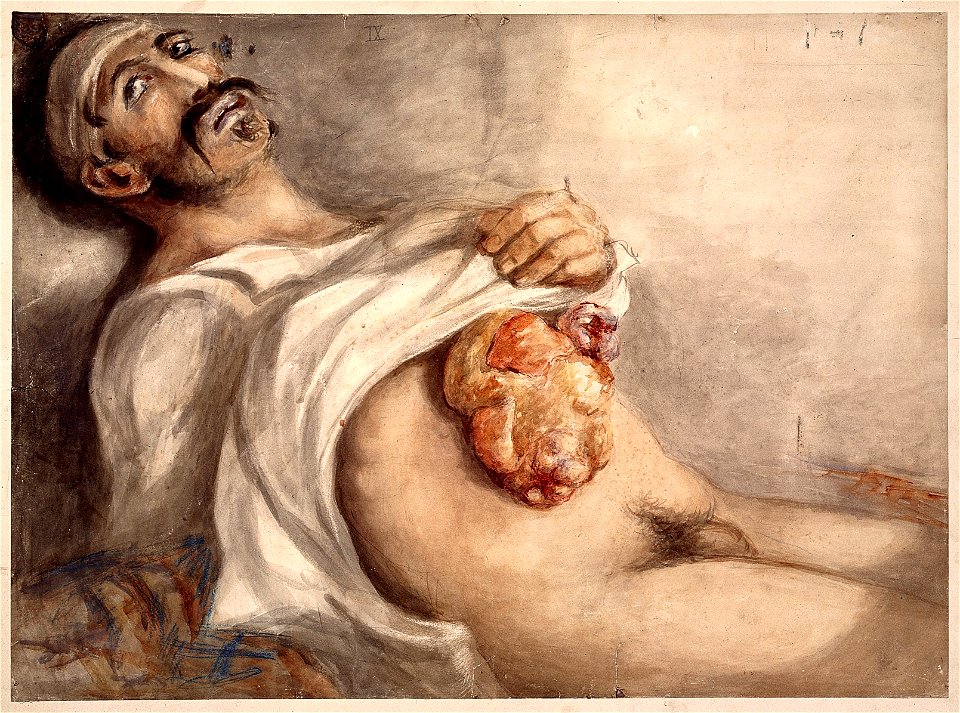 Watercolour; soldier suffering from a stomach wound Wellcome L0022547