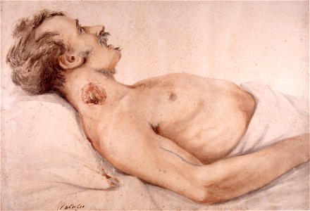 Watercolour, wounded soldier at Waterloo Wellcome L0022543
