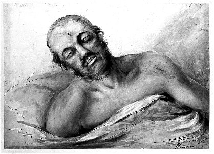 Watercolour; soldier suffering from head and facial injuries. Wellcome L0022540