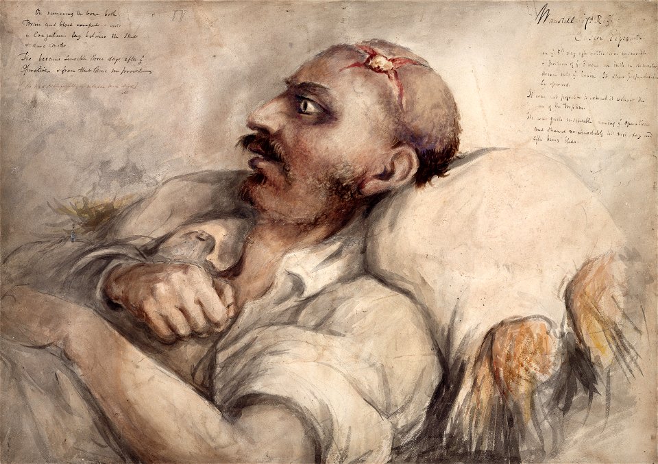 Watercolour, wounded soldier at Waterloo Wellcome L0022548