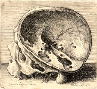 Wenceslas Hollar - Skull with the left side of cranium removed