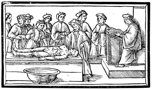 Jacobus Berengarius Anatomia carpi Titelholzschnitt 1535 (Isny)