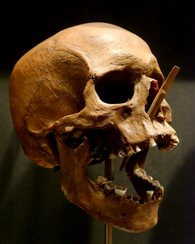 Porsmose man skull Nationalmuseet