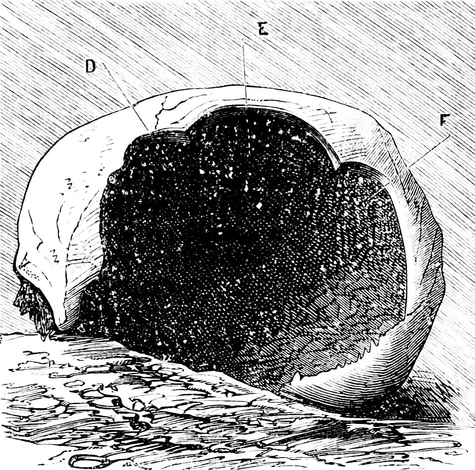 PSM V07 D626 Perforated cranium from lozere