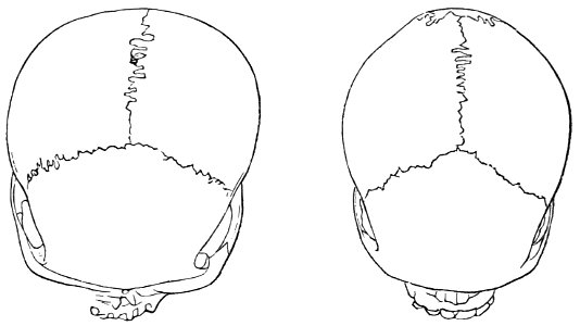 PSM V18 D767 Skulls from papua and tasmania