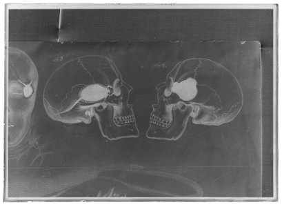 Teckning Karl XIIs kranium profil h och v - Livrustkammaren - 60288-negative