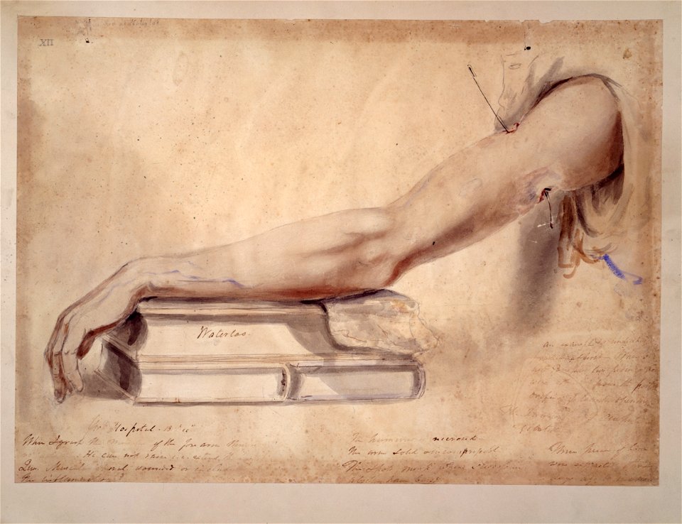 Watercolour; arm wound; by Sir Charles Bell, 1815 Wellcome L0022545