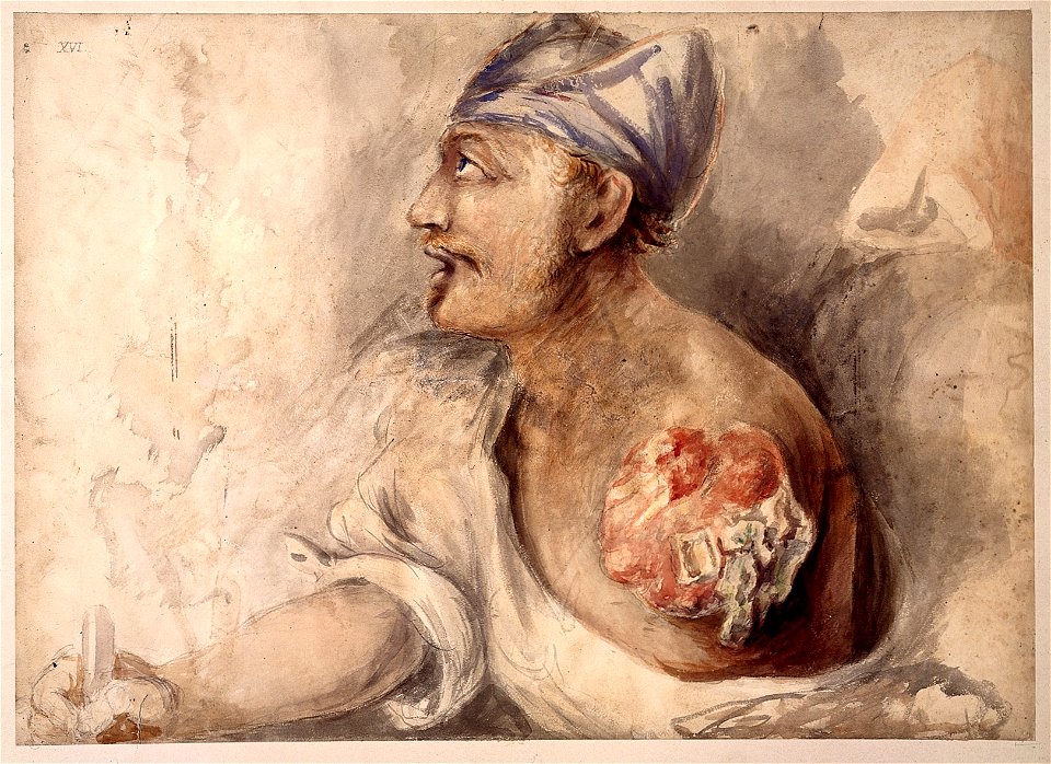 Watercolour; soldier with left arm missing Wellcome L0022552