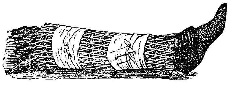 Grierson 38a Entablillado de pierna con cubremacetas. Free illustration for personal and commercial use.