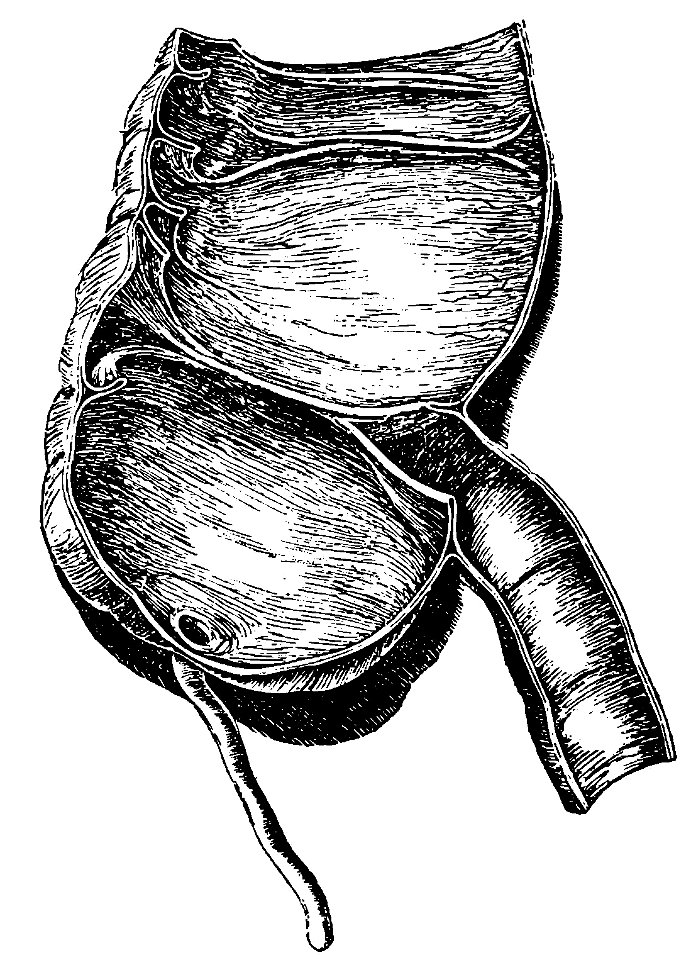 Grierson 30 Intestino