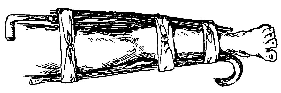 Grierson 39c Entablillado de pierna con bastón y paraguas. Free illustration for personal and commercial use.
