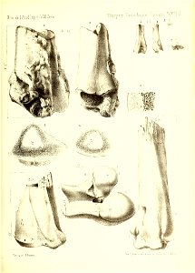 n462_w1150