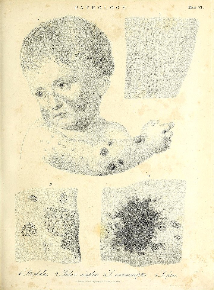 n374_w1150