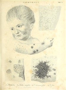 n374_w1150