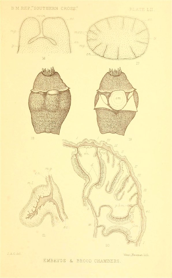 n452_w1150