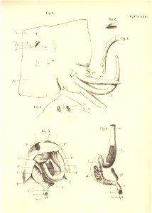 n78_w1150