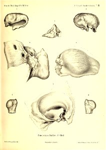 n398_w1150