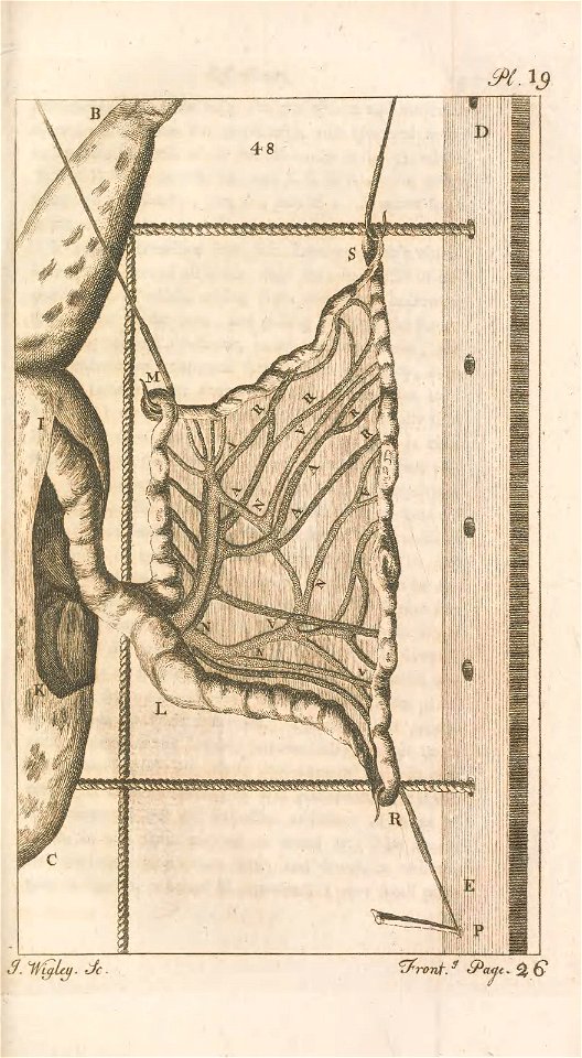 n152_w1150